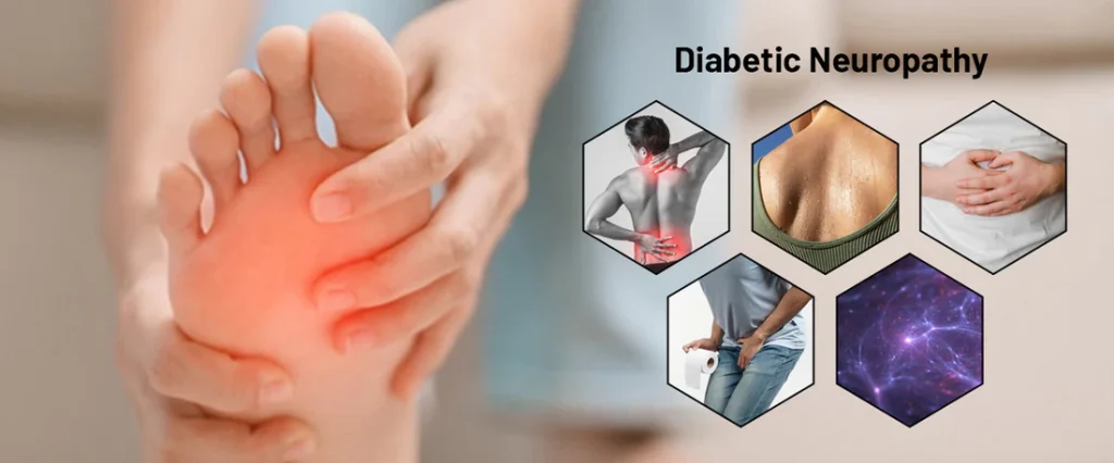 Diabetic Neuropathy 1