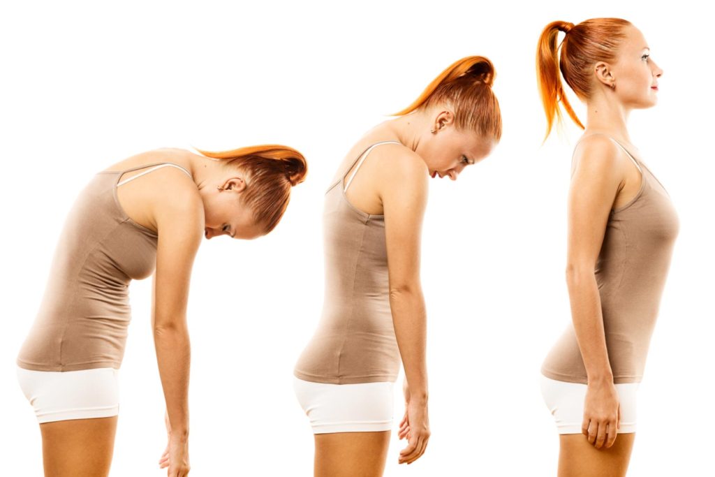 The Importance of Good Posture for a Healthy Spine 6 How to Have Good Posture