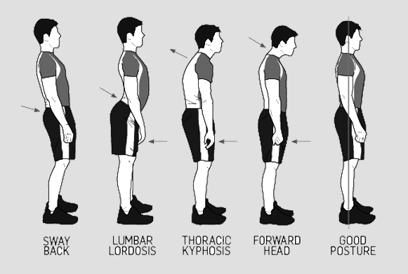 The Importance of Good Posture for a Healthy Spine 8 posture