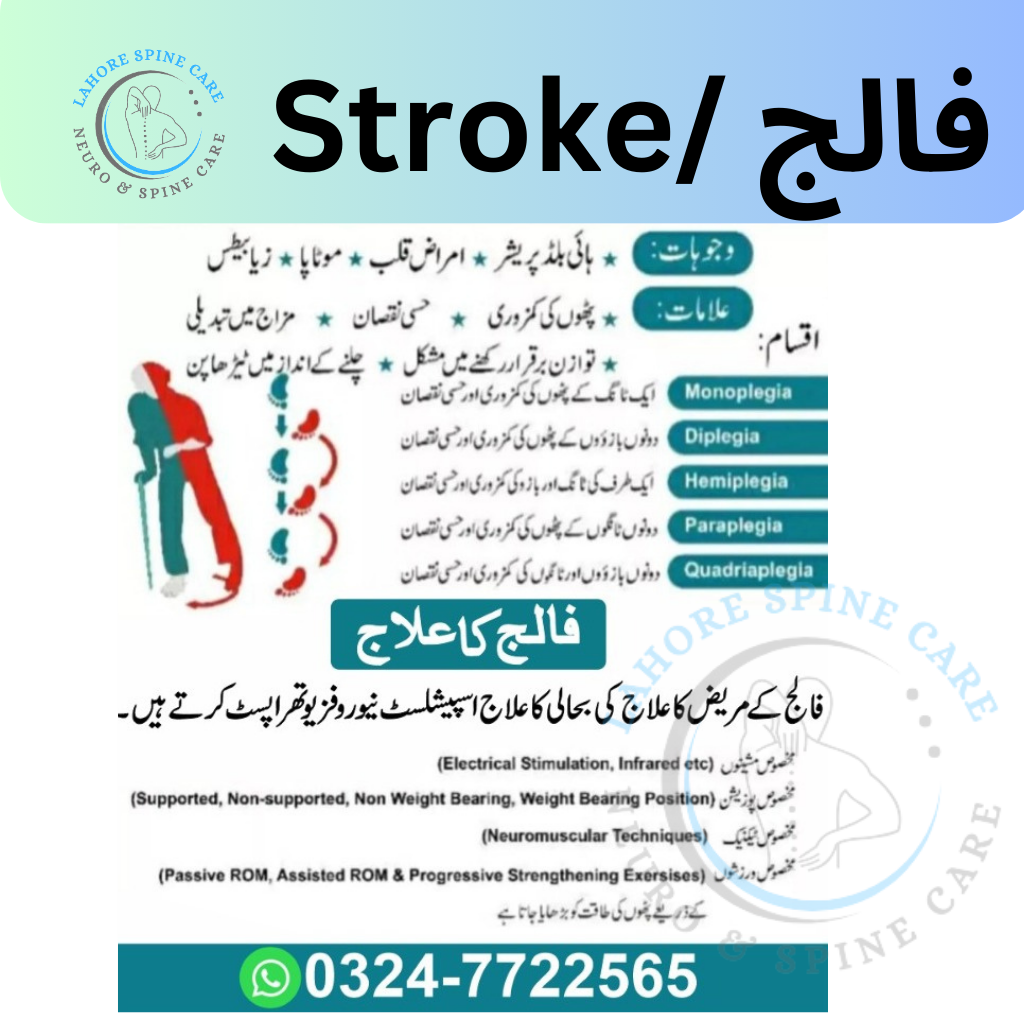 stroke physiotherapy