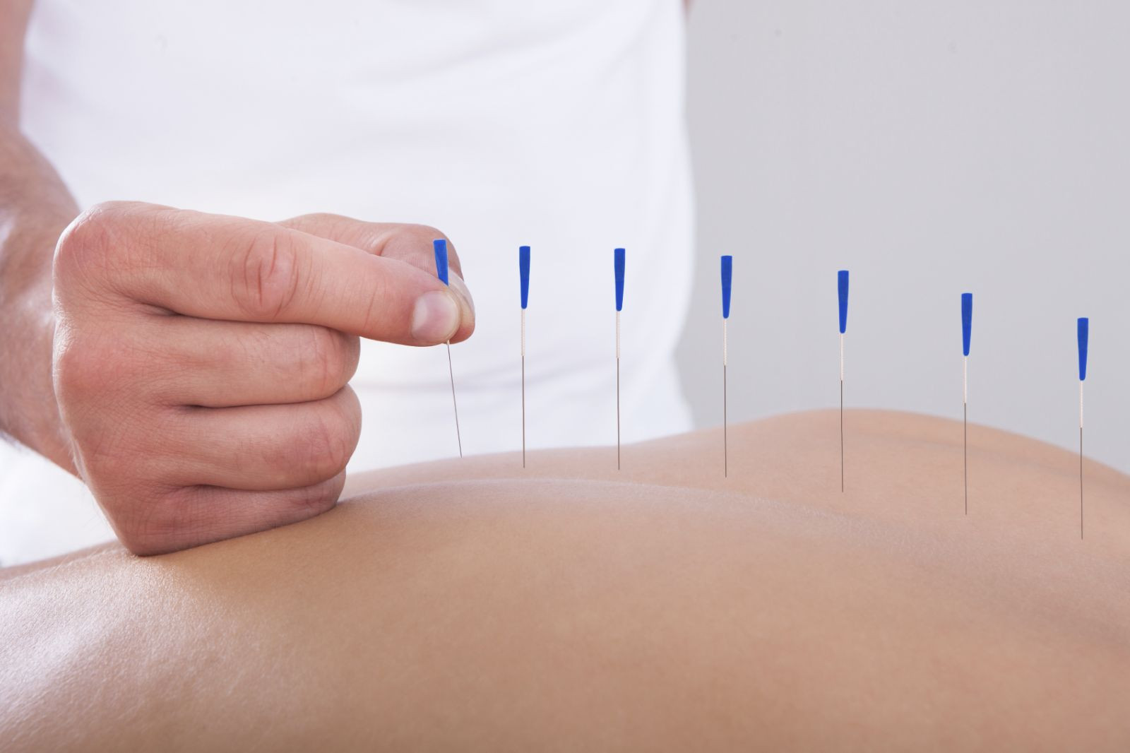 Deep understanding about Dry Needling 4 Dry Needling