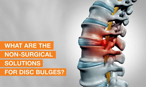 How to Diagnose Disc Bulge: Causes, Symptoms, and Treatment 4 images 1 1