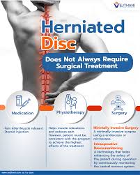 The Latest Advances in Disc Herniation Surgery: What You Need to Know 6 images 10