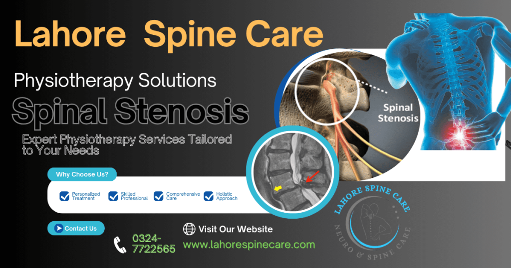 Spinal Stenosis
