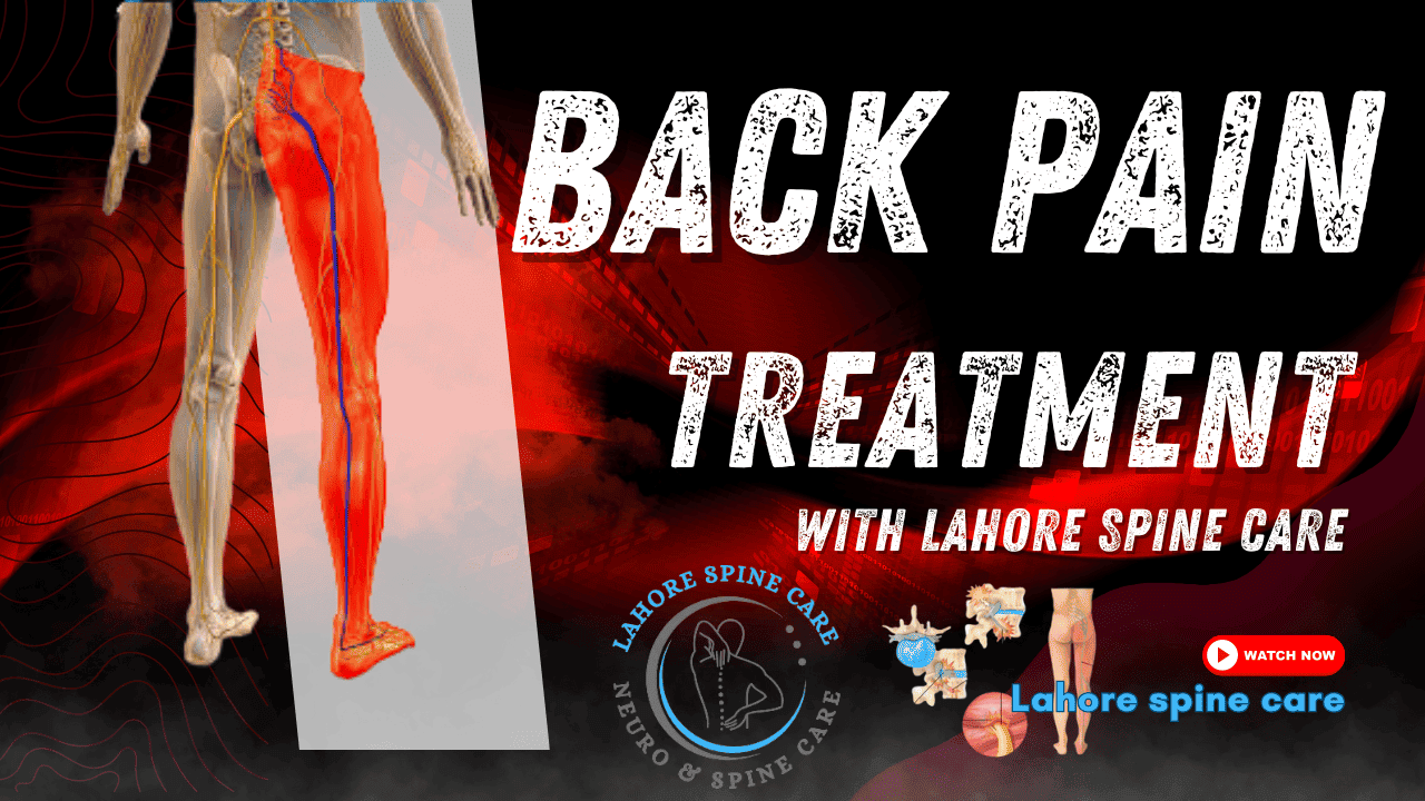 Effective Back Pain Treatment: Discover the Best Solutions for Relief 1 Lahore Spine Care provides nor surgical Back Pain Treatment