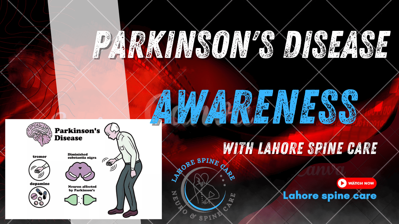 Parkinson's Disease Awareness: How to Support Those Affected 7 Parkinson's Disease Awareness